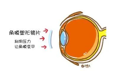 进出口眼镜报关若何归类？